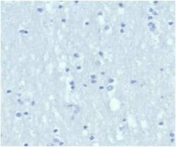 Cytokeratin 6a Rabbit anti-Human, Clone: KRT6/3997R, Novus Biologicals:Antibodies:Primary